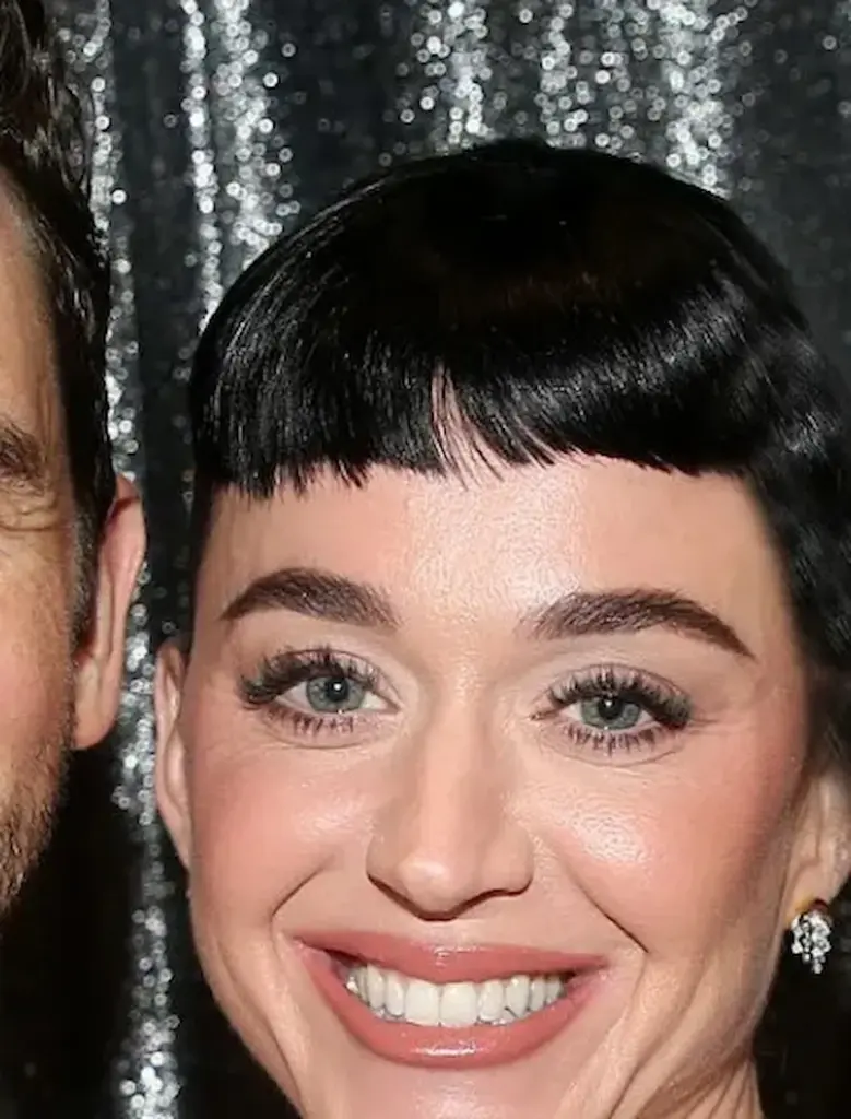 Katy Perry after dental work